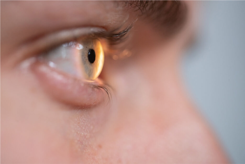 Frau mit klarer Sicht nach Hornhautverkrümmung-Laserbehandlung